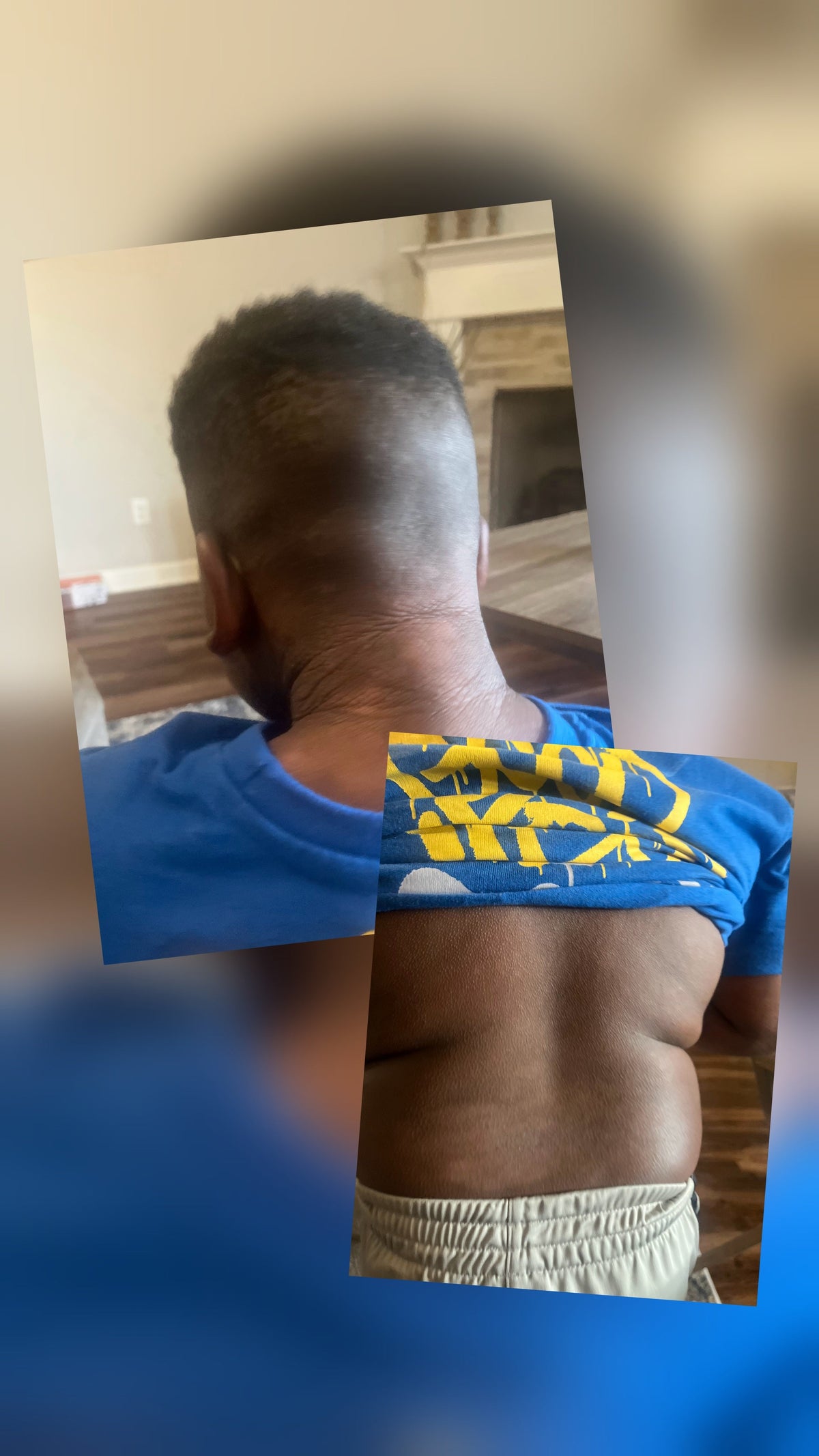 healed chronic eczema